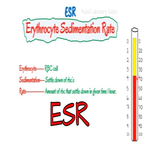 ERYTHROCYTE SEDIMENTATION RATE (ESR) ERYTHROCYTE SEDIMENTATION RATE (ESR)