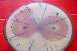 COMPARATIVE STUDIES ON PHOSPHATE SOLUBILISING BACTERIA  FROM DIFFERENT RHIZOSPHERIC SOIL