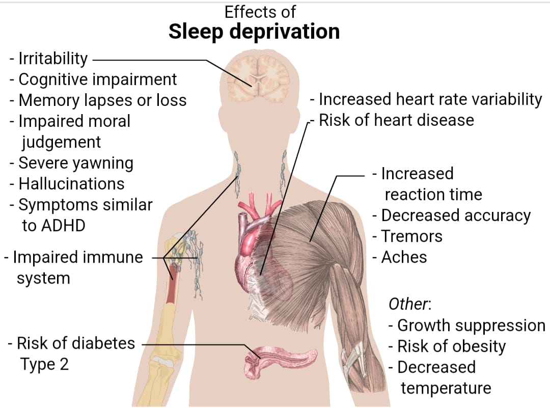 EFFECT OF DEFICIENT SLEEP ON REACTION TIME