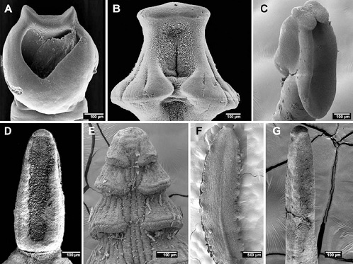 SCANNING ELECTRON MICROSCOPIC STUDY OF CIRCUMONCOBOTHRIUM SP.  INFECTING MASTACEMBELUS ARMATUS