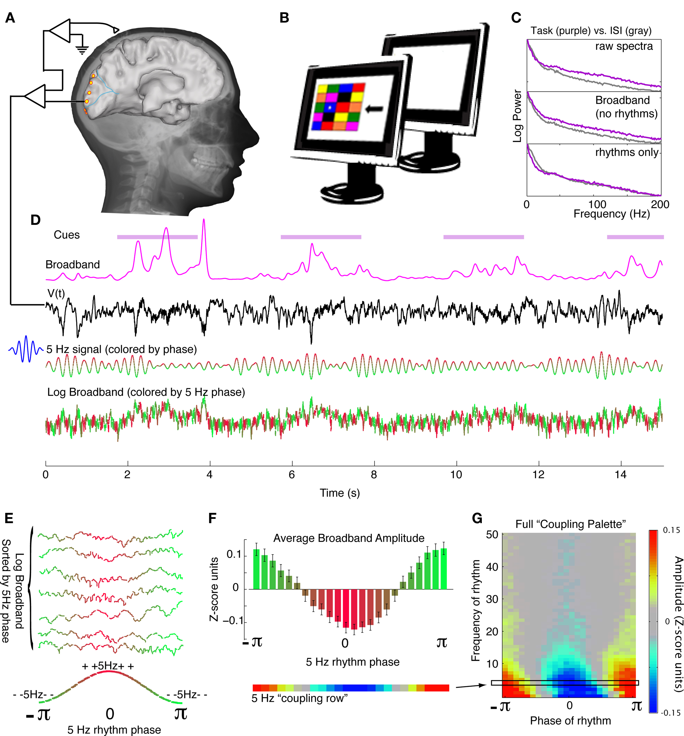 ANALYSIS OF EPILEPTIC SEIZURE DETECTION METHODS BASED ON PARAMETER ESTIMATION, POWER SPECTRUM DENSITY AND MORLET WAVELET TRANSFORM