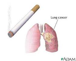 IMPACT OF CURCUMIN ON NICOTINE-INDUCED LUNG CHANGE: HISTOPATHOLOGICAL, BIOCHEMICAL AND IMMUNOLOGICAL STUDY