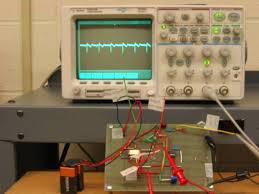 BASELINE WANDER AND POWER LINE INTERFERENCE NOISE REMOVAL IN ECG USING DIGITAL IIR FILTER