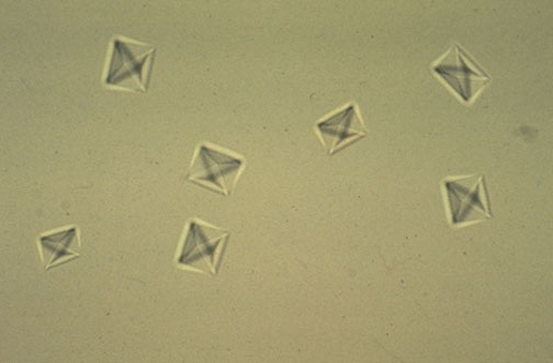 COMPARATIVE STUDIES ON GEL GROWN  OXALATE CRYSTALS