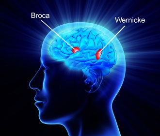 CLINICAL APPLICATION OF INDIGENOUS  COMMUNICATION SOFTWARE FOR IMPROVING  COMMUNICATION ABILITY OF PATIENTS WITH  BROCA’S APHASIA