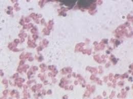 SCREENING AND OPTIMIZATION OF   POLYHYDROXYBUTYRATE (PHB)FROM AZOTOBACTER SPP 