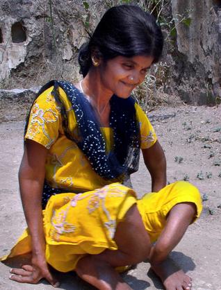 IMPACT OF FLUORIDE CONTAMINATION ON HUMAN  HEALTH: A CASE STUDY OF KHARAI VILLAGE OF PURULIA DISTRICT 
