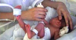 A STUDY TO ASSESS THE EFFECT OF TACTILE –KINESTHETIC  STIMULATION ON SELECTED PHYSIOLOGICAL PARAMETERS  AND NEUROBEHAVIORAL DEVELOPMENT AMONG LOW  BIRTH WEIGHT NEONATES ADMITTED IN NICU OF SELECTED HOSPITALS  AT INDORE CITY.