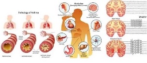 UTILITY OF SHONITSTHAPAN MAHAKASHAYA IN VARIOUS BLOOD DISORDERS UTILITY OF SHONITSTHAPAN MAHAKASHAYA IN VARIOUS BLOOD DISORDERS